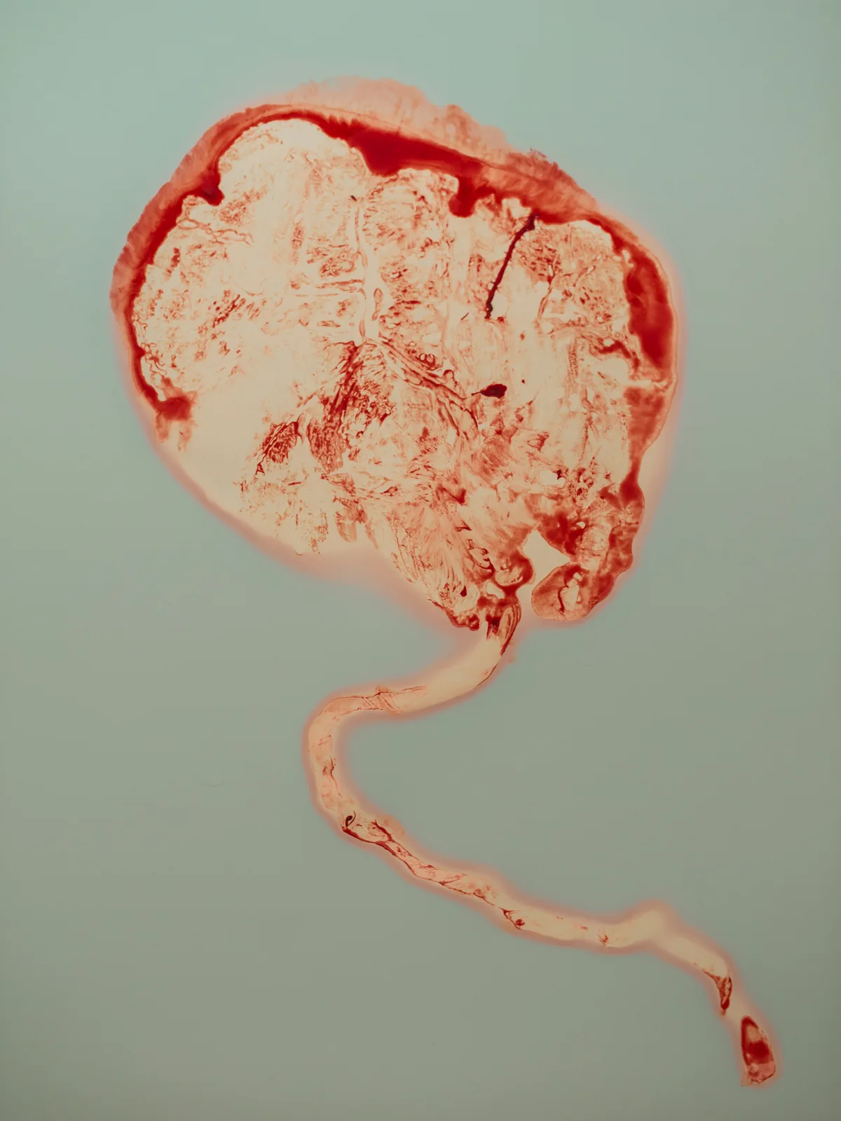 The Placenta